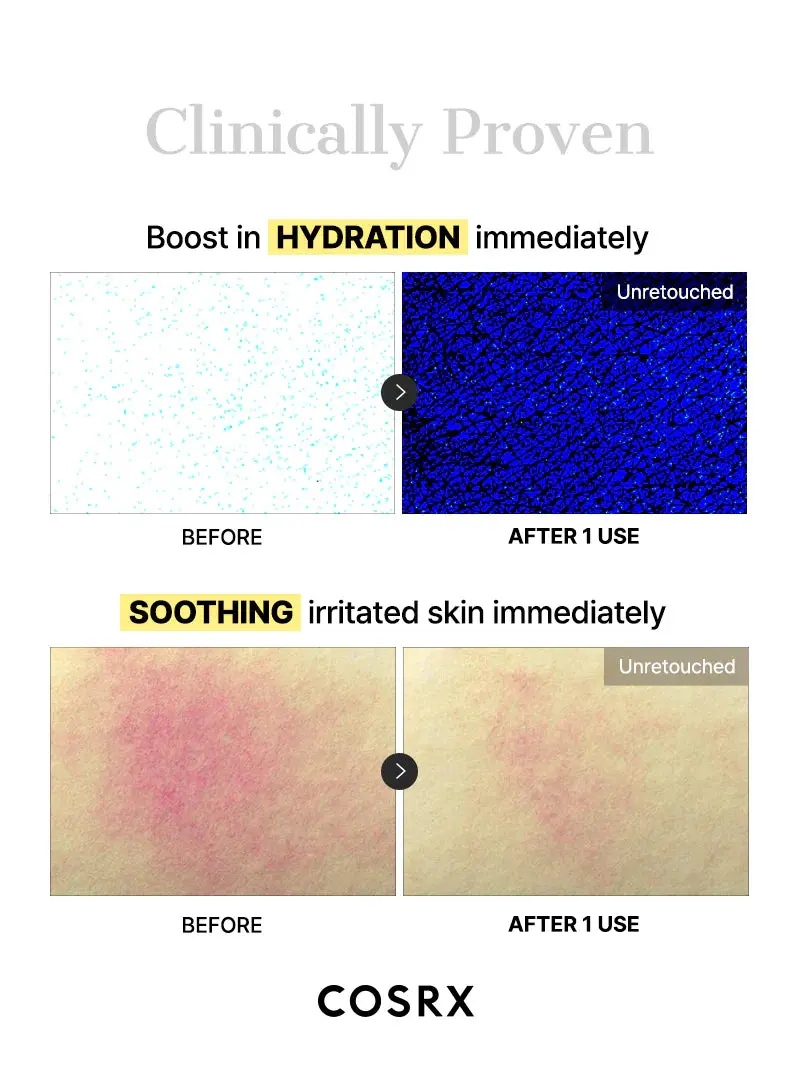 Advanced Snail Mucin Glass Glow Hydrogel Mask 3-Pack - Image 11