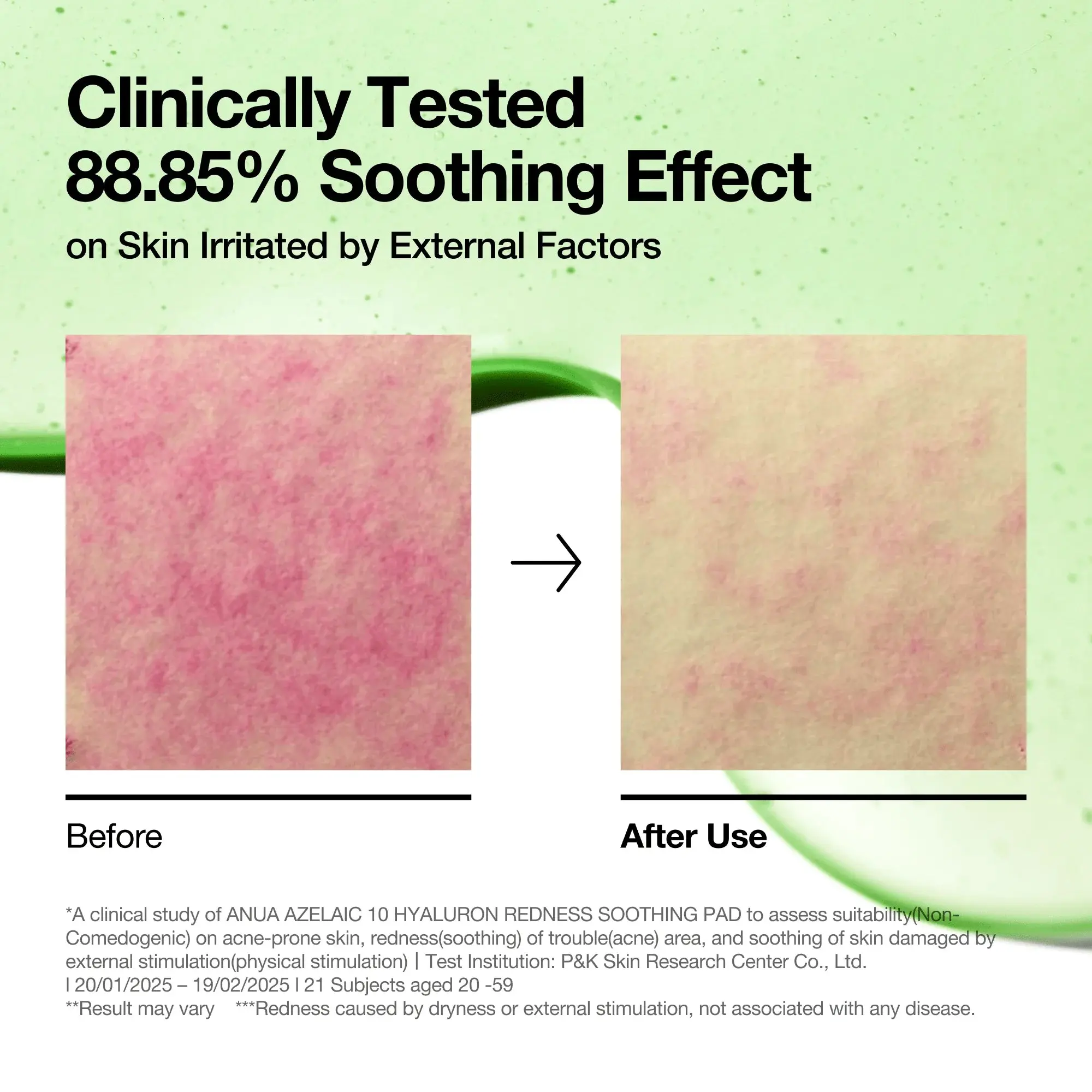 Acid 10 Hyaluron Redness Soothing Pad - Image 6