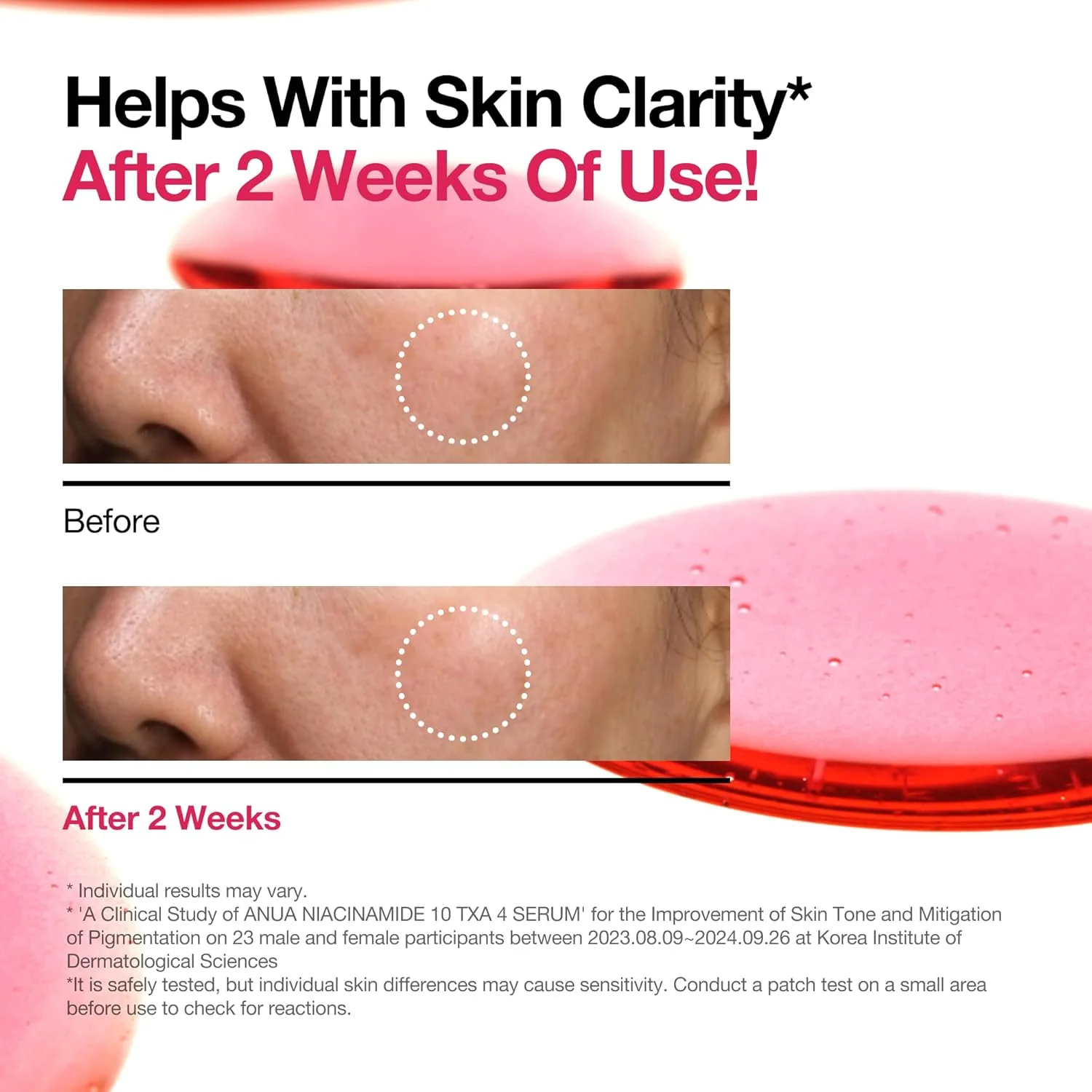 Niacinamide 10% + TXA 4% Dark Spot Correcting Serum - Image 5