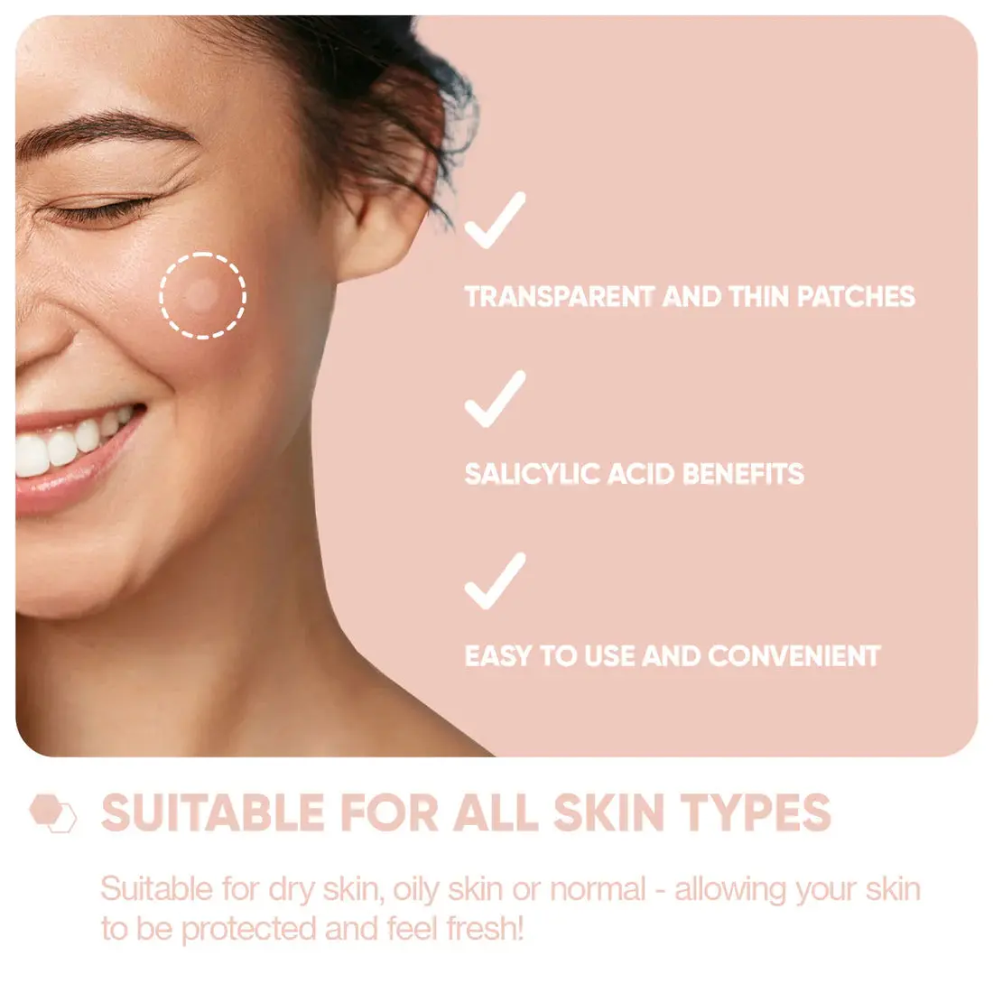 Emergency Dots For Spots and Blemishes Salicylic Acid - Image 3