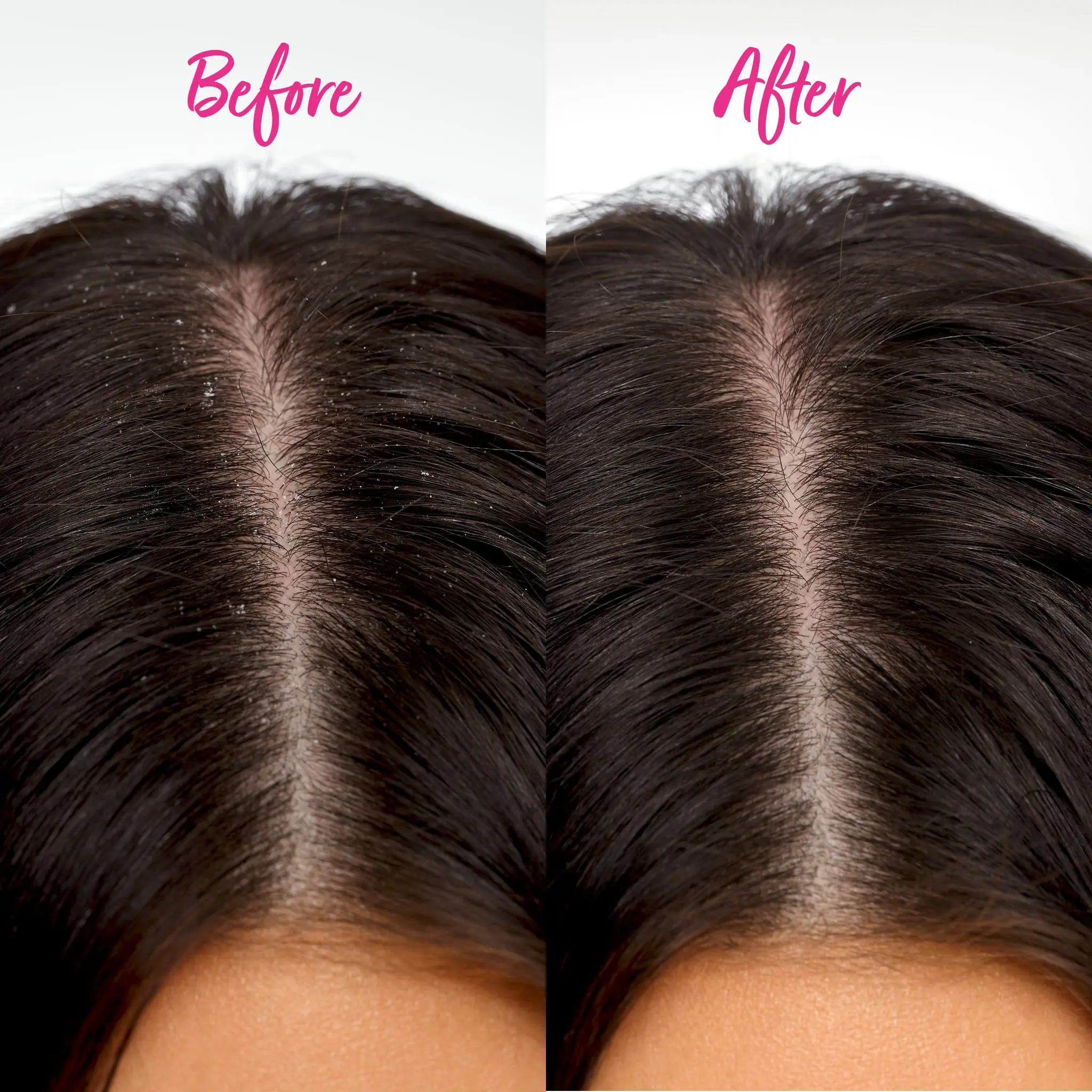 Scalp Detox Comb - Image 2