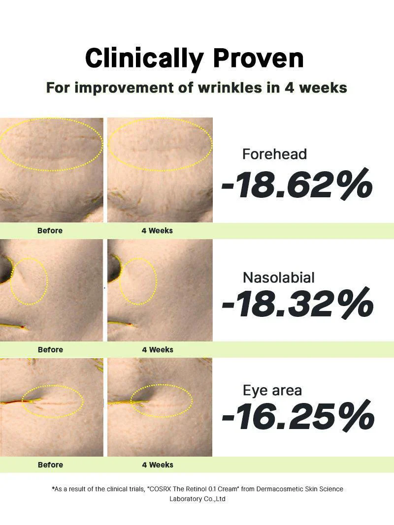 The Retinol 0.1 Cream - Image 10