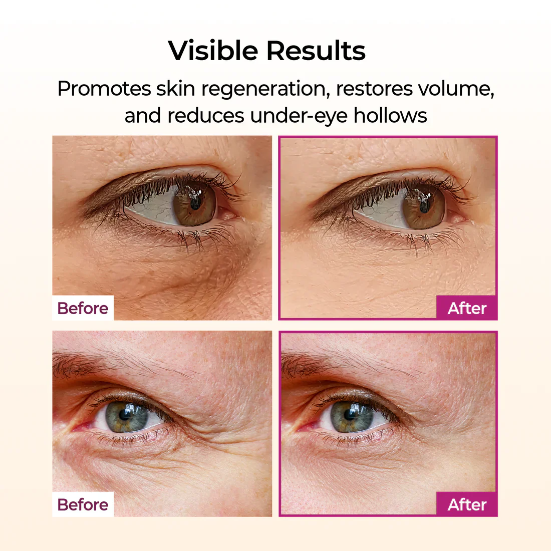 Cemenrete Calcium Volume Multi Balm - Image 5