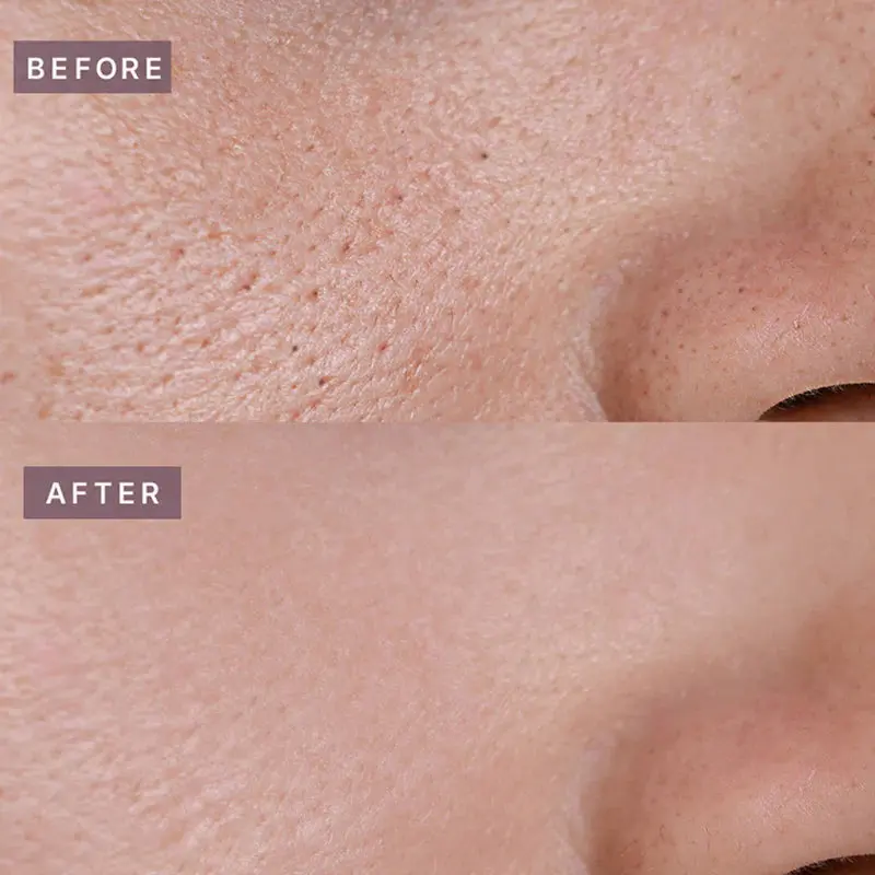 Pot Pore Tightening Podo Ampoule - Image 3