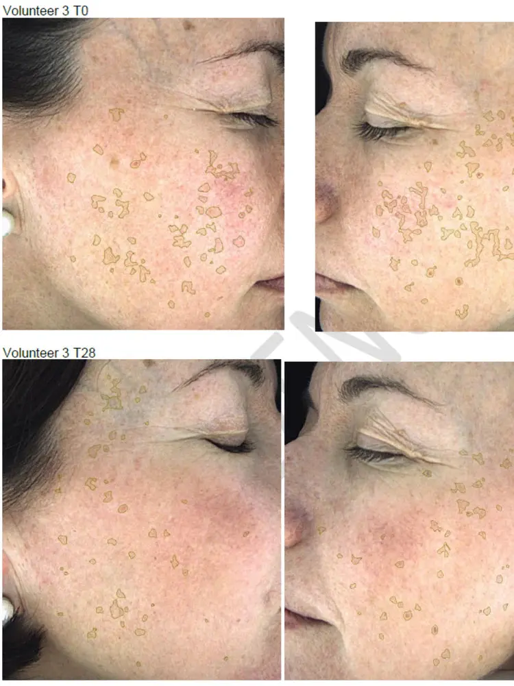 Hyperpigmentation Serum - 2% Alpha Arbutin + 1% Kojic Acid - Image 2