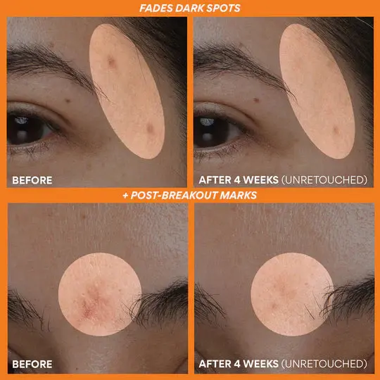 Vitamin C Green Tea Enzyme Brightening Serum - Image 5