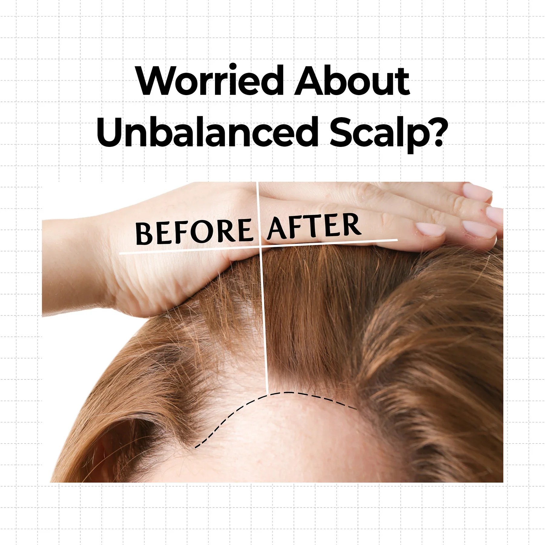 10x Caffeine Strengthening Scalp Serum - Image 6