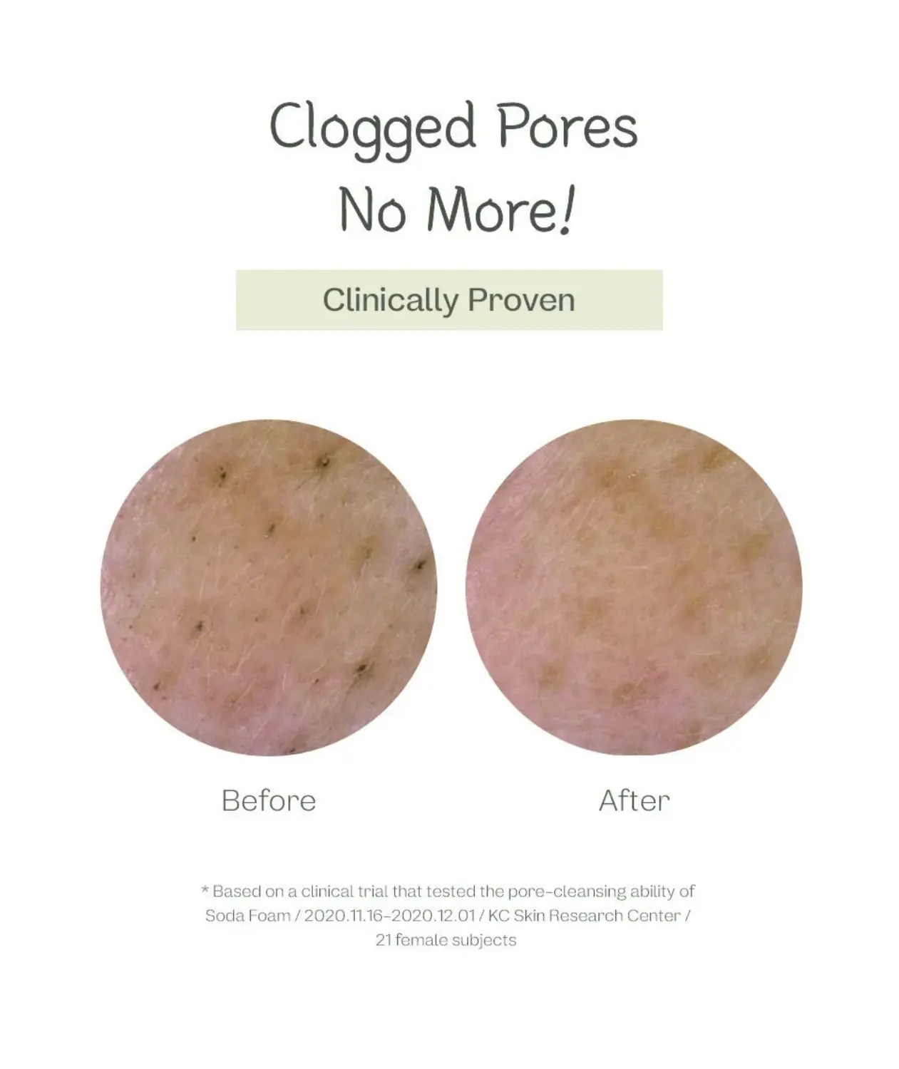 Deep Pore Cleansing Soda Foam - Image 7