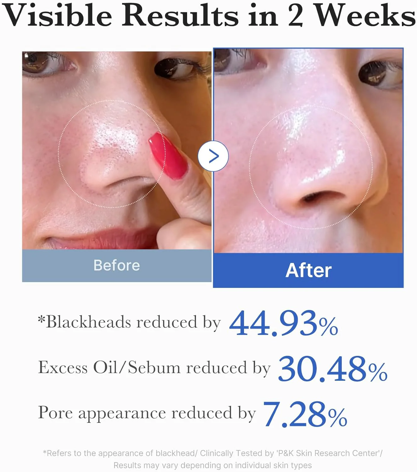 Zero Pore Pad 2.0 - Image 7