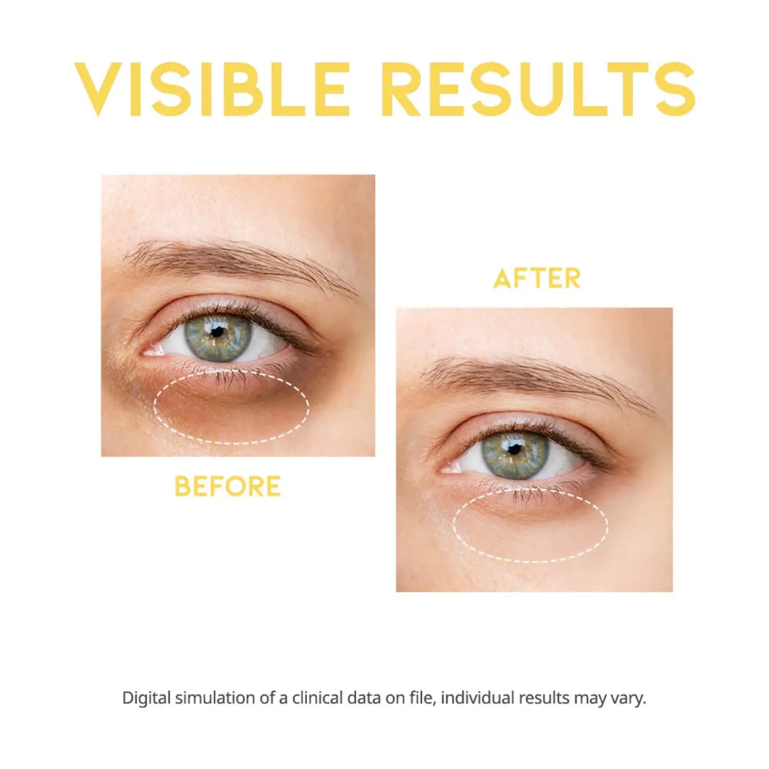 OOTD Dark Circle Eye Serum - Image 4