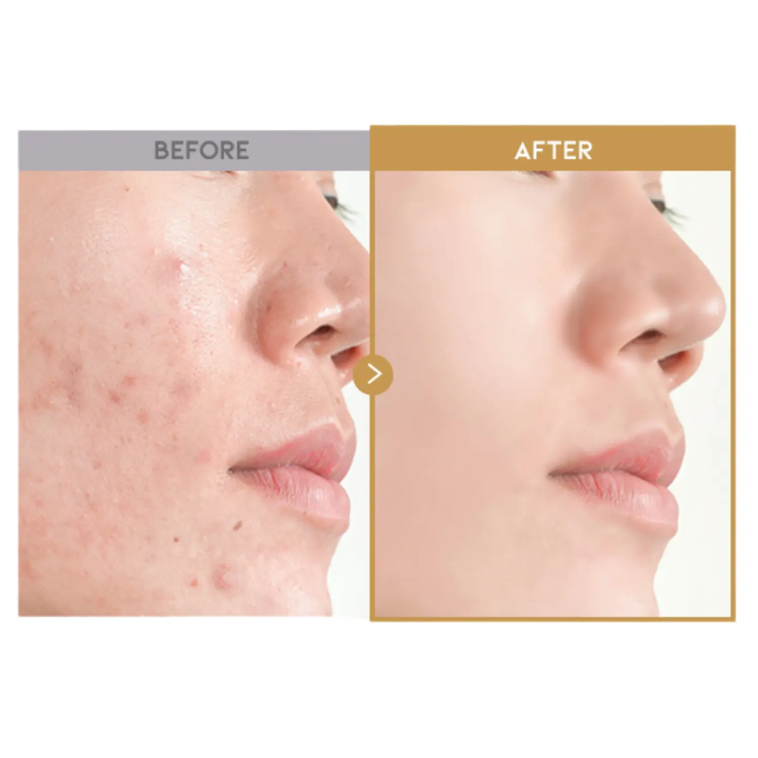Glass Skin Rice Water Toner Pad - Image 3