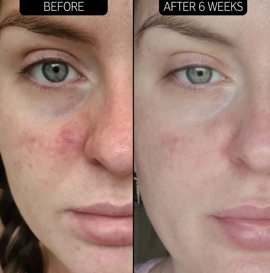 SuperSolutions Redness Relief Solution - Image 4